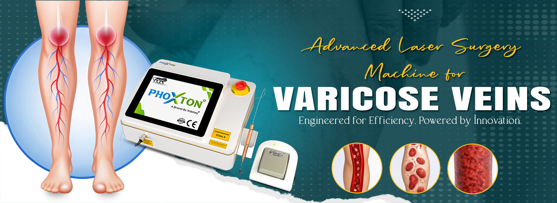 Advanced Laser Surgery Machine for Varicose Veins